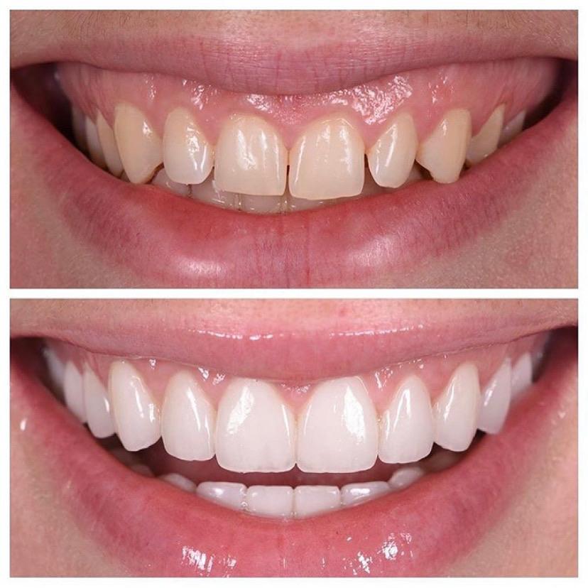 Rehabilitación completa